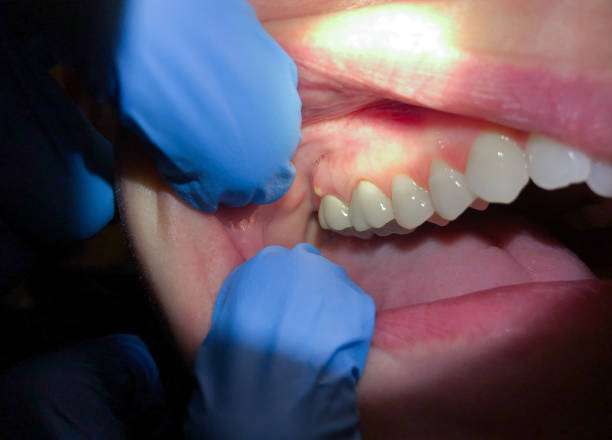 Best Emergency Treatment for Jaw Pain or Injury in Kodi, AK